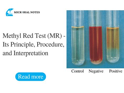 escherichia coli methyl red test|Methyl Red (MR) Test.